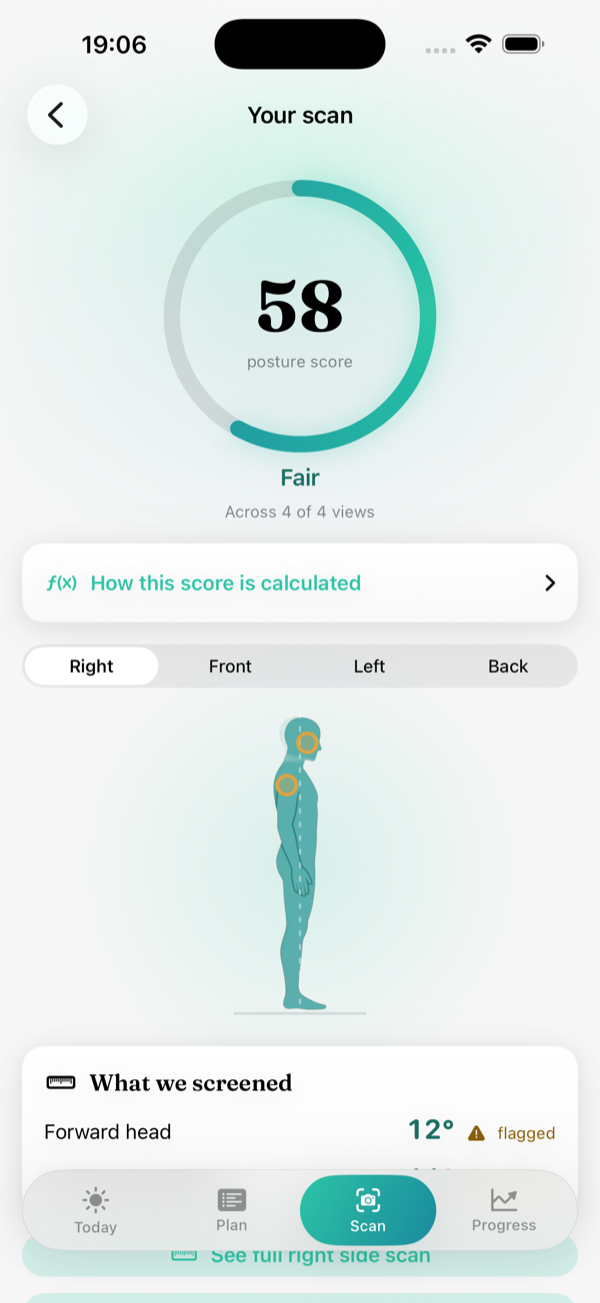 Your scan result screen with an honest posture score